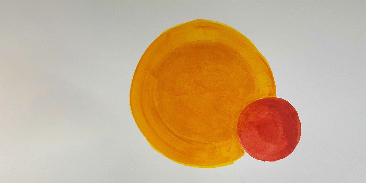 Камни в жёлчном пузыре